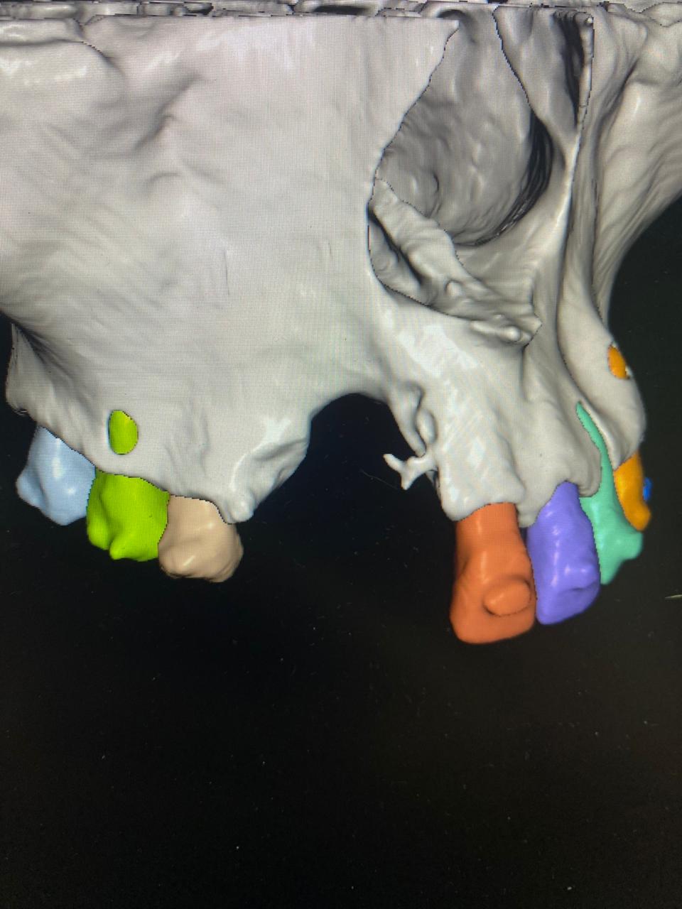 Planificación de cirugía oral avanzada en Dental Center Córdoba